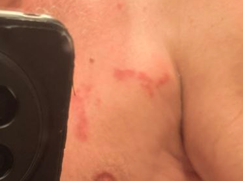 Покрылся красными пятнами.