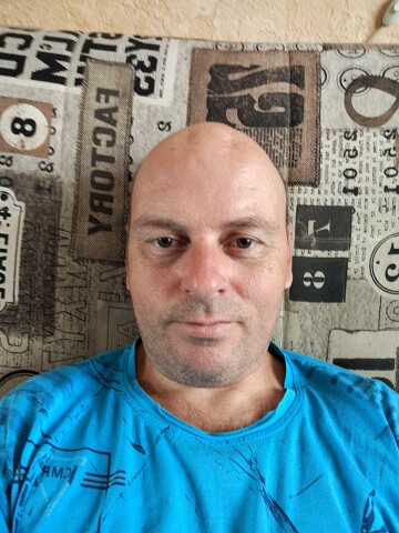 Николай Глушнёв, Россия, Качканар, 46 лет. В 1981(3) была травма головы - получил Эписиндром. За время учёбы она перешла в Эпилепсию. После око