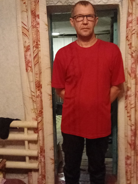 Я год назад - заболевание кардинально измменило мою внешность. 😔